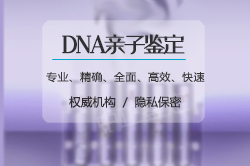 甘肃司法亲子鉴定如何做[鉴定咨询]