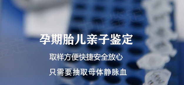 甘肃省怀孕47天能办理产前亲子鉴定吗,
