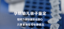 甘肃省怀孕47天能办理产前亲子鉴定吗